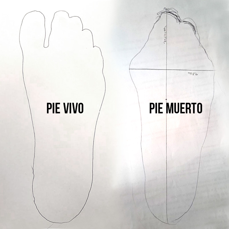 PieSanoVivoyPieMuertoDeformado