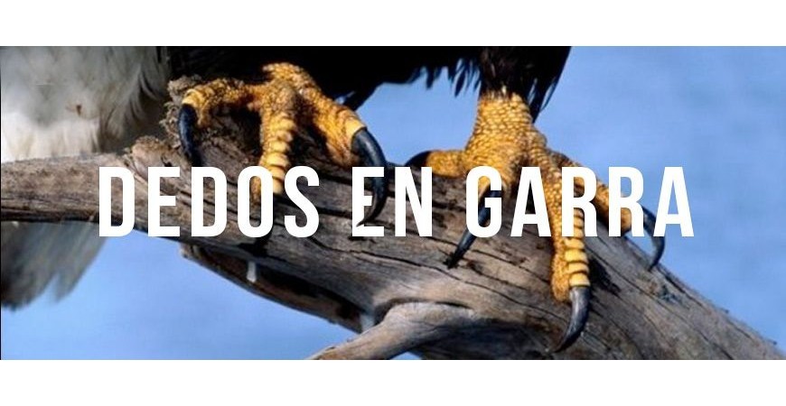 Não coloque no pé se você tiver dedos tortos