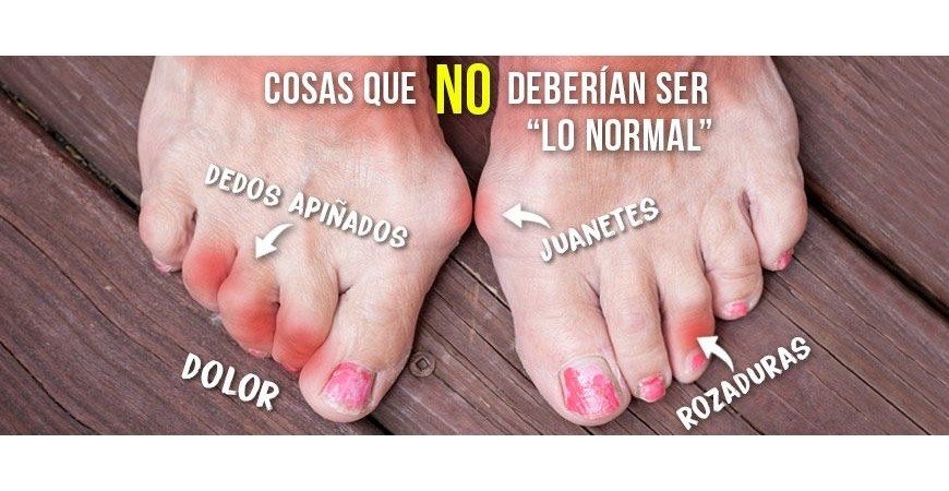 Tu pie se deforma por el calzado