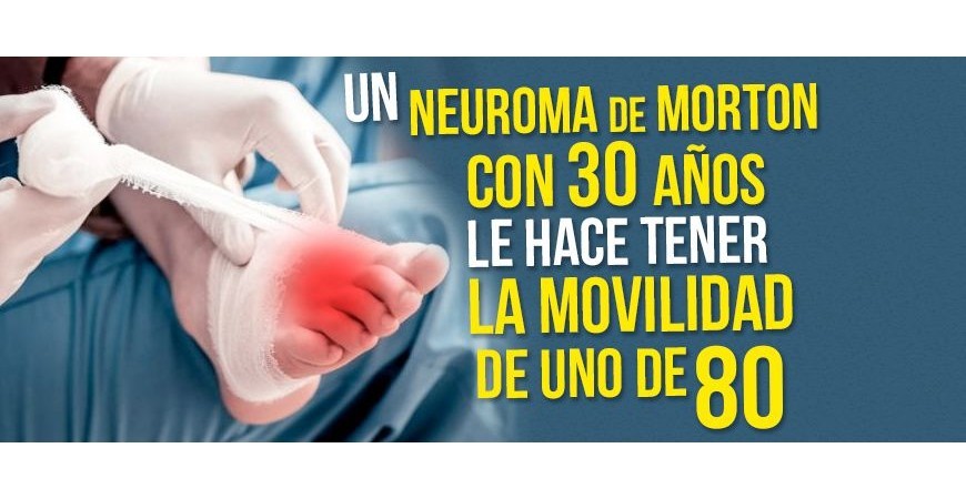 Neuroma de Morton aos 30 anos faz com que ele tenha a mobilidade de um homem de 80 anos