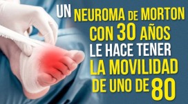 Un Neuroma de Morton con 30 años le hace tener la movilidad de uno de 80