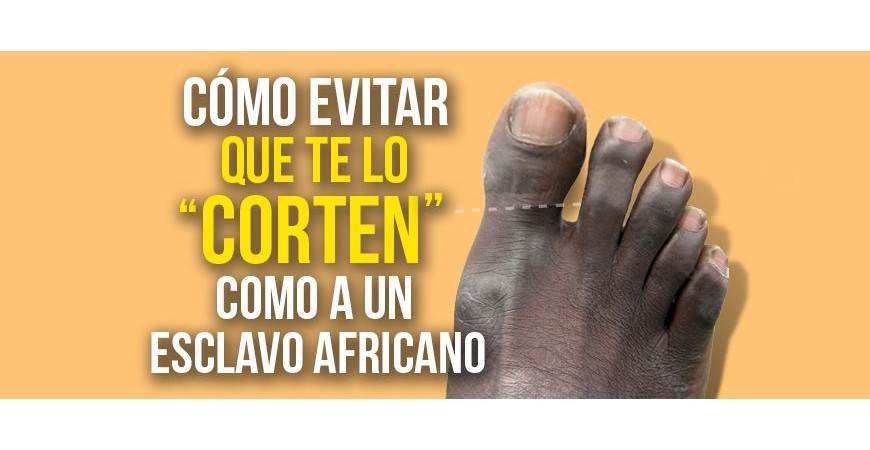 Como evitar ter o dedo grande do pé cortado como um escravo africano