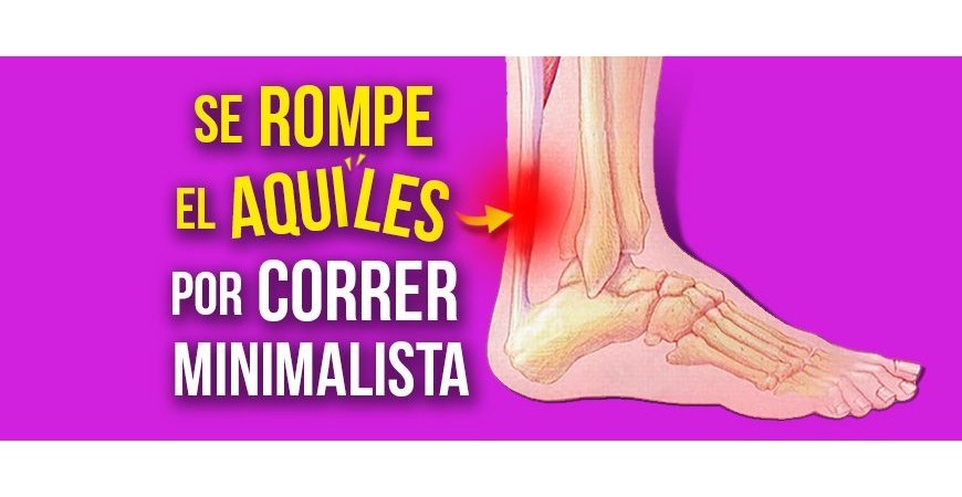 She breaks her Achilles for running minimalist