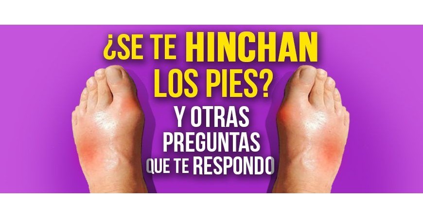 Seus pés incham?... e outras perguntas que eu respondo