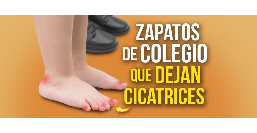 School shoes that leave scars: my experience and how to protect your child