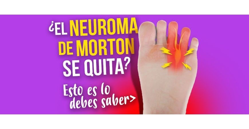 Verschwindet das Morton-Neurom? Das sollten Sie wissen