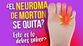 Verschwindet das Morton-Neurom? Das sollten Sie wissen
