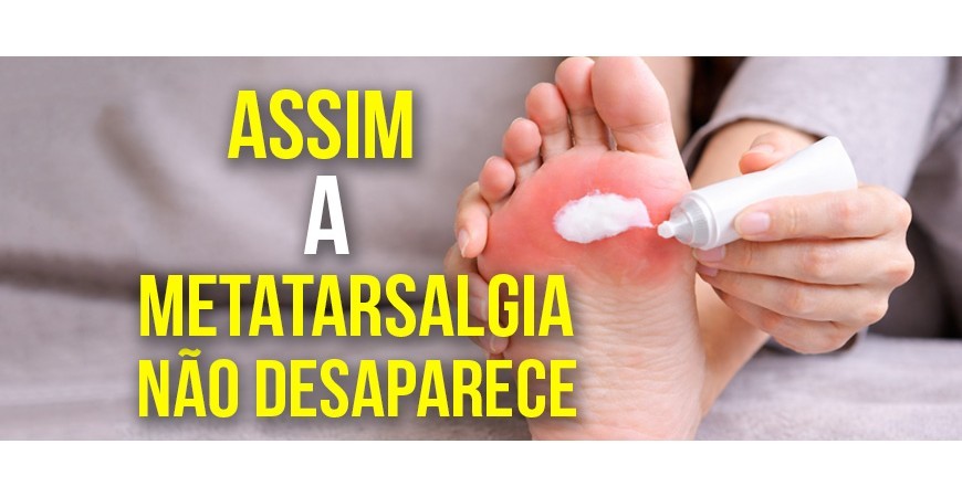 Nem pomadas nem palmilhas resolvem o problema da metatarsalgia