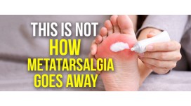 Neither ointments nor insoles so the metatarsalgia does not go away