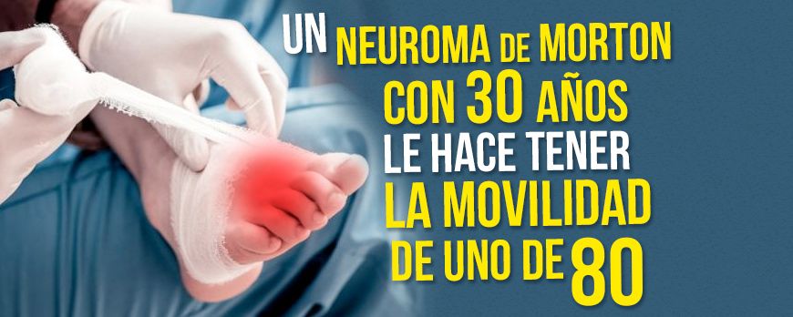 A Morton's Neuroma at the age of 30 makes him have the mobility of an 80-year-old