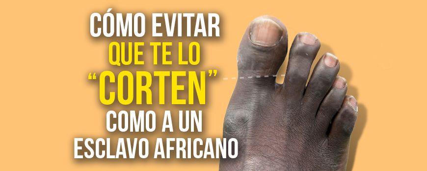 How to avoid having your big toe cut off like an African slave