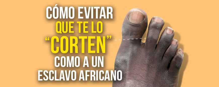 Como evitar ter o dedo grande do pé cortado como um escravo africano