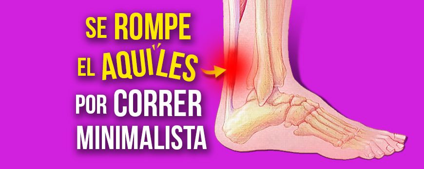 Se rompe el Aquiles por correr minimalista