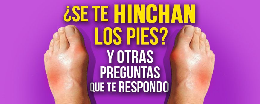 Do your feet swell?... and other questions that I answer