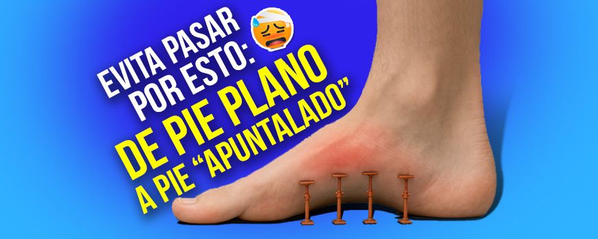 Pés chatos: o que eu faria 30 dias antes da cirurgia