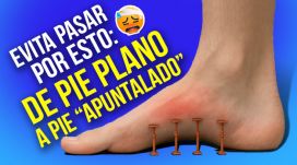 Pies planos: lo que haría 30 días antes de operarme