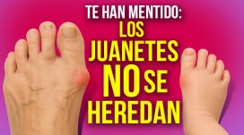 Tus juanetes no son herencia, son culpa de tus zapatos (y lo sabes)